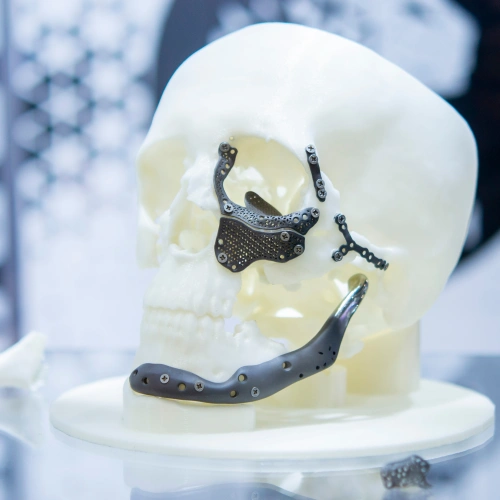 This is Medical Stainless Steel vs Titanium: A Comparison of Two Key Materials in Healthcare photo